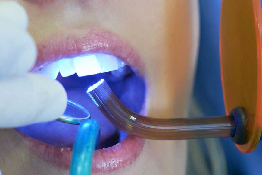 Odontoiatria estetica6