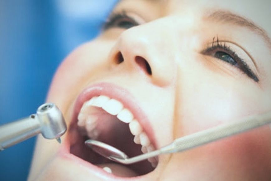 Devitalizzare un dente e prevenire le lesioni pulpari